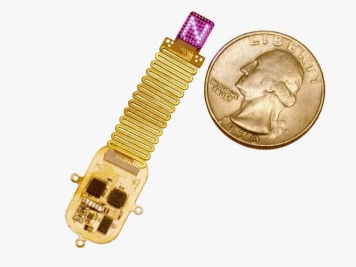 Ιατρική επανάσταση με μικροσκοπικό εμφύτευμα που «μιλά» στον εγκέφαλο: Βοηθά στην αποκατάσταση χαμένων αισθήσεων και στη διαχείριση του πόνου