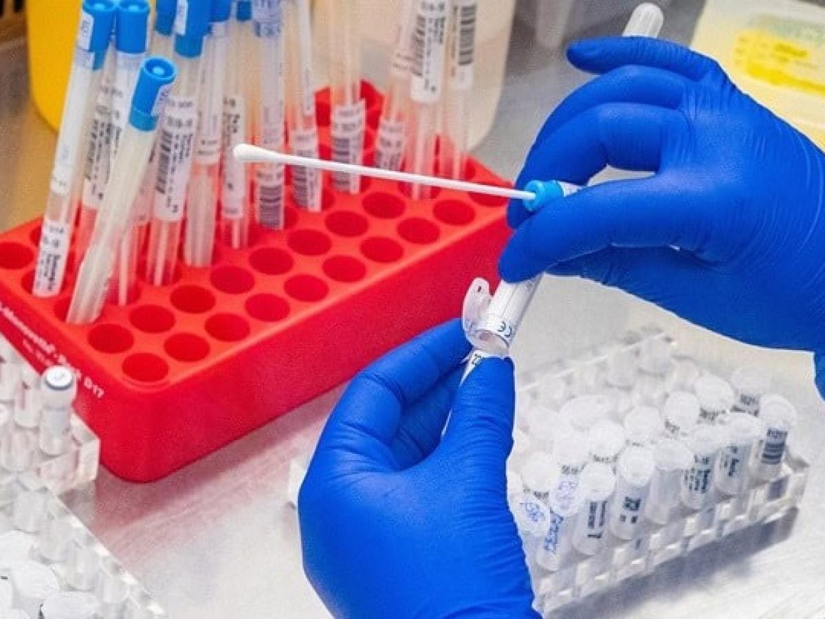 Στρεπτόκοκκος: Πώς γίνεται η διάγνωση, τι πρέπει να προσέχουν οι γονείς