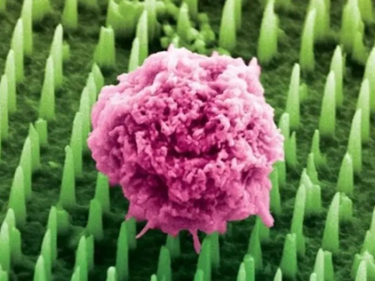 Ιατρικές εξελίξεις του 2025: Νέα ελπίδα για ασθενείς με σπάνιες νόσους