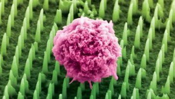 Ιατρικές εξελίξεις του 2025: Νέα ελπίδα για ασθενείς με σπάνιες νόσους