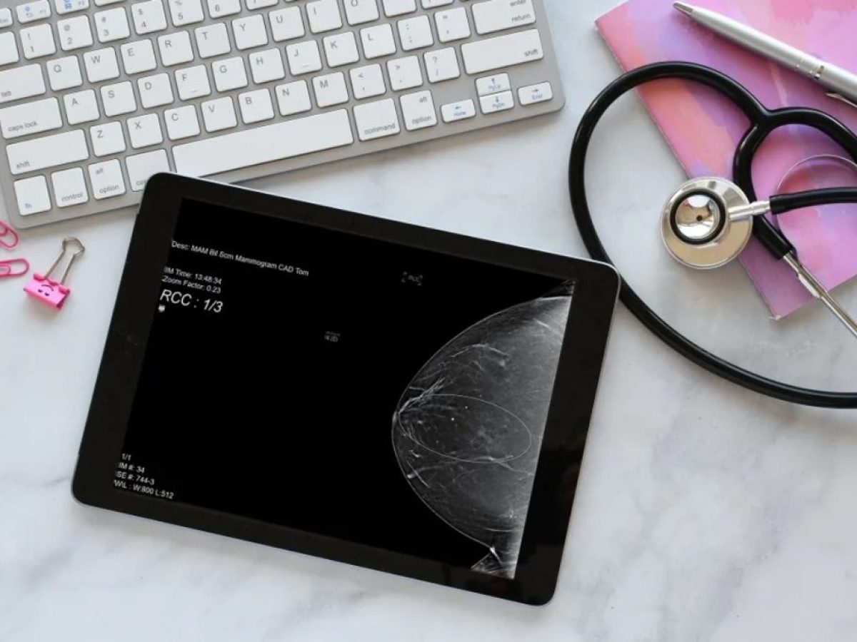 Καρκίνος του μαστού: Νέα δεδομένα αλλάζουν τον τρόπο πρόληψης της νόσου