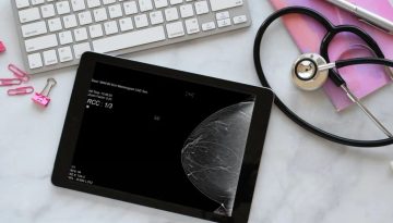 Καρκίνος του μαστού: Νέα δεδομένα αλλάζουν τον τρόπο πρόληψης της νόσου