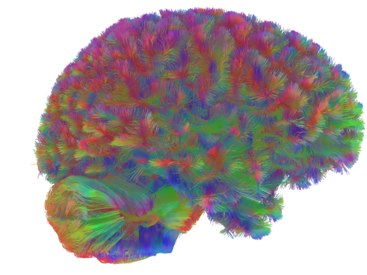 Τι μάθαμε για τον εγκέφαλο το 2025