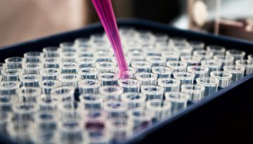 Αληθής πολυκυτταραιμία: διάγνωση και θεραπεία