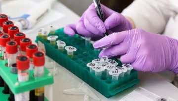 Eπτά εκατομμύρια περιπτώσεις καρκίνου ετησίως μπορούν να προληφθούν – Τι δείχνει έκθεση του ΠΟΥ