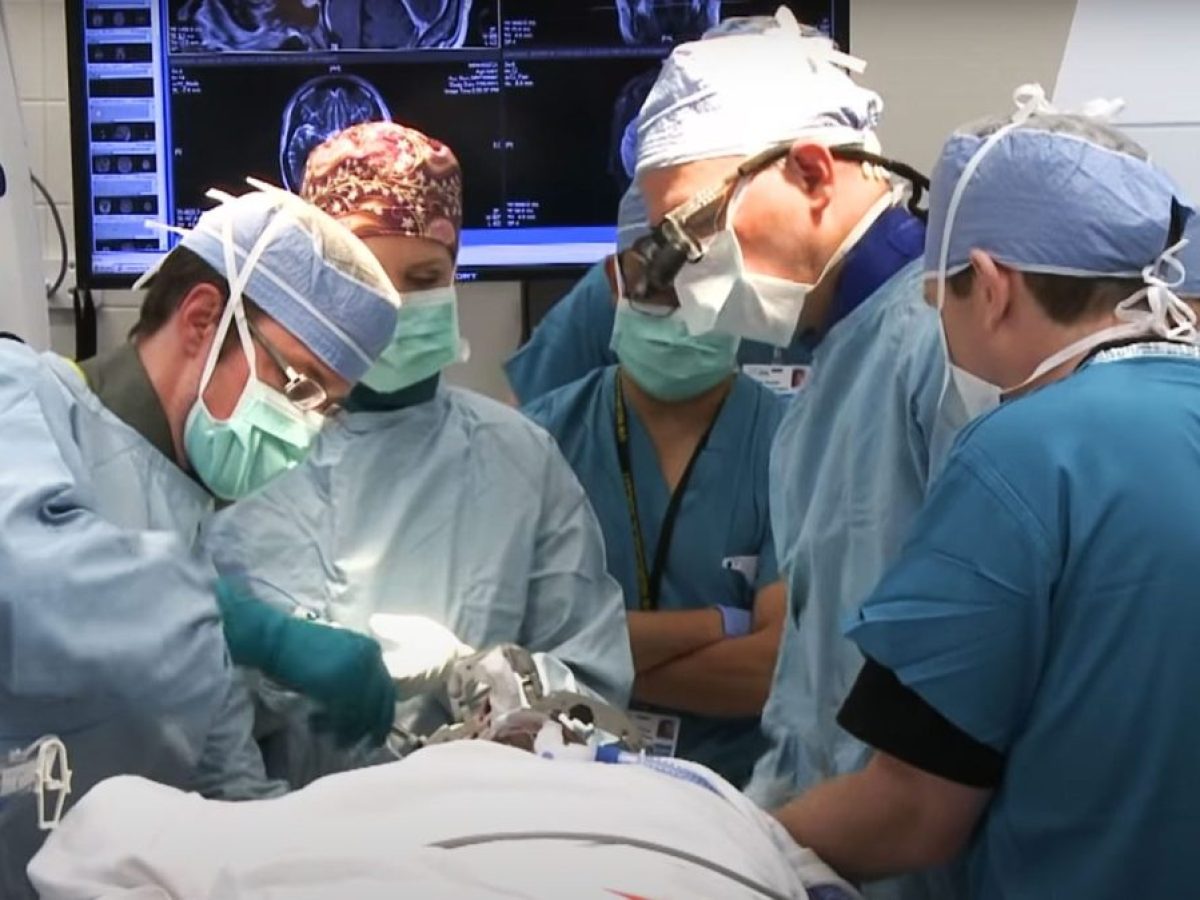 Εμφύτευμα τσιπ στον εγκέφαλο: Η τεχνολογία που ενισχύει τη νευροπλαστικότητα μετά από εγκεφαλικό