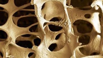 Πώς η άσκηση προστατεύει τα οστά από την οστεοπόρωση