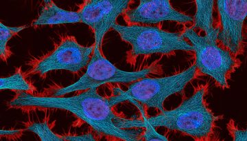 Θεραπεία – δούρειος ίππος για τον καρκίνο δίνει ελπίδες για την καταπολέμησή του