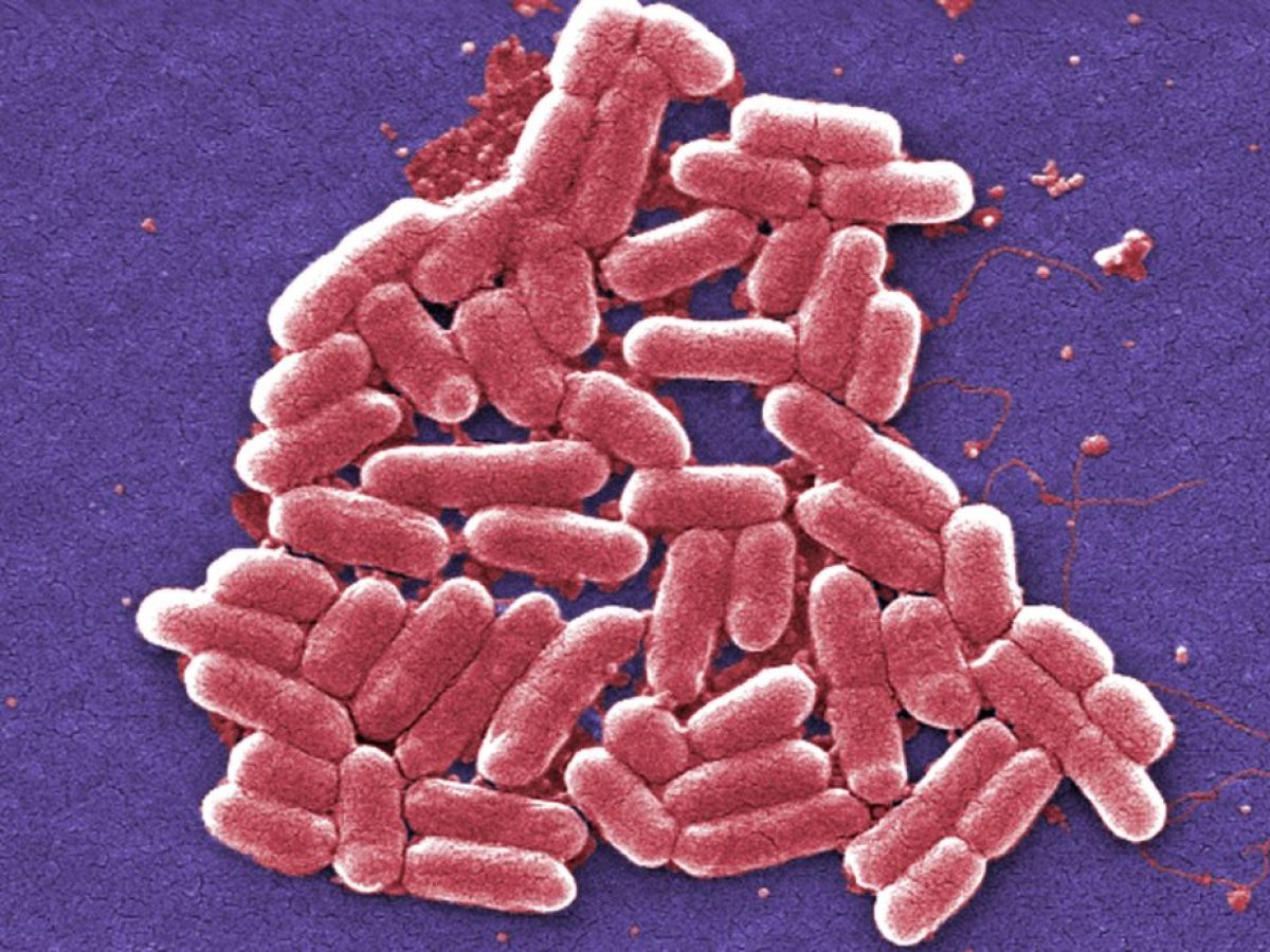 Βιοτεχνολογία: Γενετικά τροποποιημένα E. coli παράγουν ενώσεις με αντικαρκινική και αντι-HIV δράση