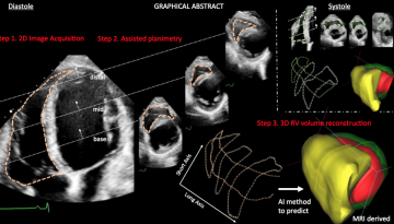 Πρωτοποριακή μέθοδος Ελλήνων επιστημόνων ανιχνεύει καρδιακά προβλήματα