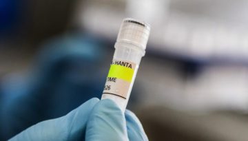 Χανταϊός: Το ξέσπασμα στο κρουαζιερόπλοιο υπογραμμίζει τη σημασία της ανάπτυξης εμβολίων mRNA, λένε ειδικοί