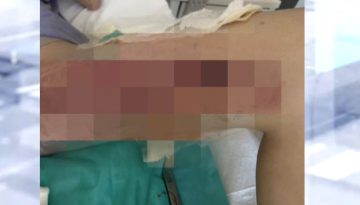 &Theta;&epsilon;&sigma;&sigma;&alpha;&lambda;&omicron;&nu;ί&kappa;&eta;: &Sigma;&epsilon; &epsilon;&phi;&iota;ά&lambda;&tau;&eta; &gamma;&iota;&alpha; 20&chi;&rho;&omicron;&nu;&eta; &epsilon;&xi;&epsilon;&lambda;ί&chi;&theta;&eta;&kappa;&epsilon; &mu;ί&alpha; &alpha;&pi;&lambda;ή &epsilon;&pi;έ&mu;&beta;&alpha;&sigma;&eta; &kappa;ύ&sigma;&tau;&eta;&sigmaf; &kappa;ό&kappa;&kappa;&upsilon;&gamma;&alpha; &ndash; &Upsilon;&pi;έ&sigma;&tau;&eta; &epsilon;&gamma;&kappa;&alpha;ύ&mu;&alpha;&tau;&alpha; 3&omicron;&upsilon; &beta;&alpha;&theta;&mu;&omicron;ύ &ndash; ertnews.gr