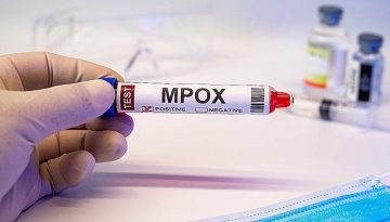Mpox: &Omicron; &iota;ό&sigmaf; &epsilon;&xi;&alpha;&pi;&lambda;ώ&nu;&epsilon;&tau;&alpha;&iota; &sigma;&epsilon; &nu;έ&epsilon;&sigmaf; &chi;ώ&rho;&epsilon;&sigmaf; &ndash; &Pi;ώ&sigmaf; &mu;&pi;&omicron;&rho;&epsilon;ί &nu;&alpha; &pi;&epsilon;&rho;&iota;&omicron;&rho;&iota;&sigma;&tau;&epsilon;ί &eta; &nu;έ&alpha; έ&xi;&alpha;&rho;&sigma;&eta; &ndash; ertnews.gr